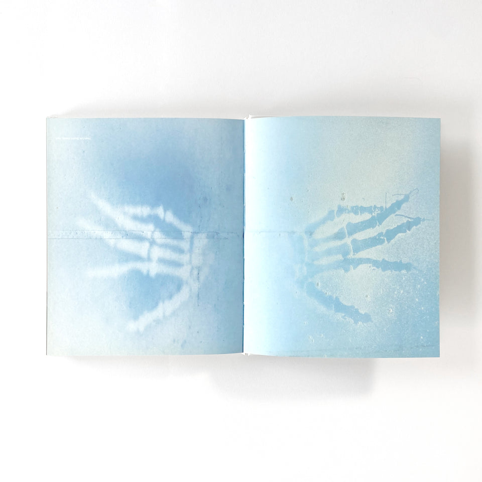 Christine Borland, Preserves